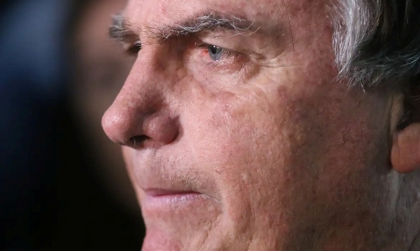 Com crise persistente de soluços, Bolsonaro faz nova cirurgia